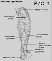 Ахиллова сухожилия Ахиллова сухожилия