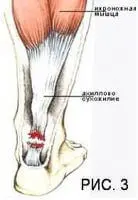 publish 09 03 1 138 200