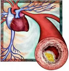 publish 15 03 235 244