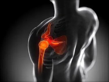 Боли в плечевом суставе при поднятии руки Боли в плечевом суставе при поднятии руки