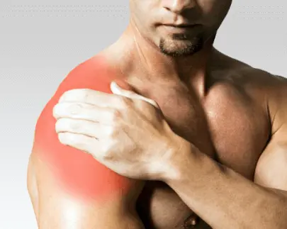 Боль в плечевом суставе Боль в плечевом суставе