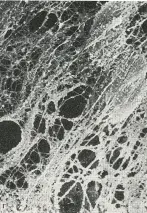 Метод коррекции эндотелиальной стресс-реакции