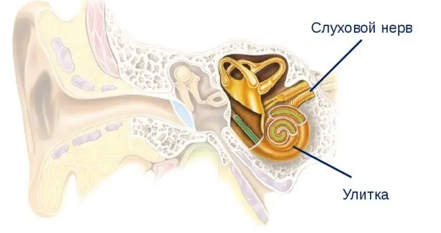 шум у вухах