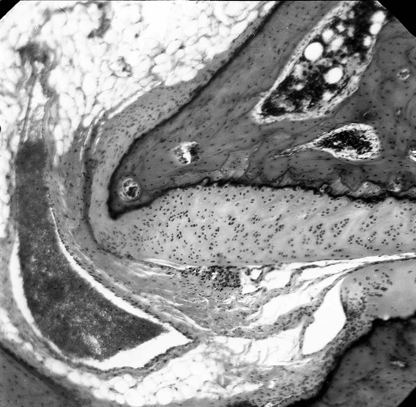 Лікування артрозу суглобів в Києві