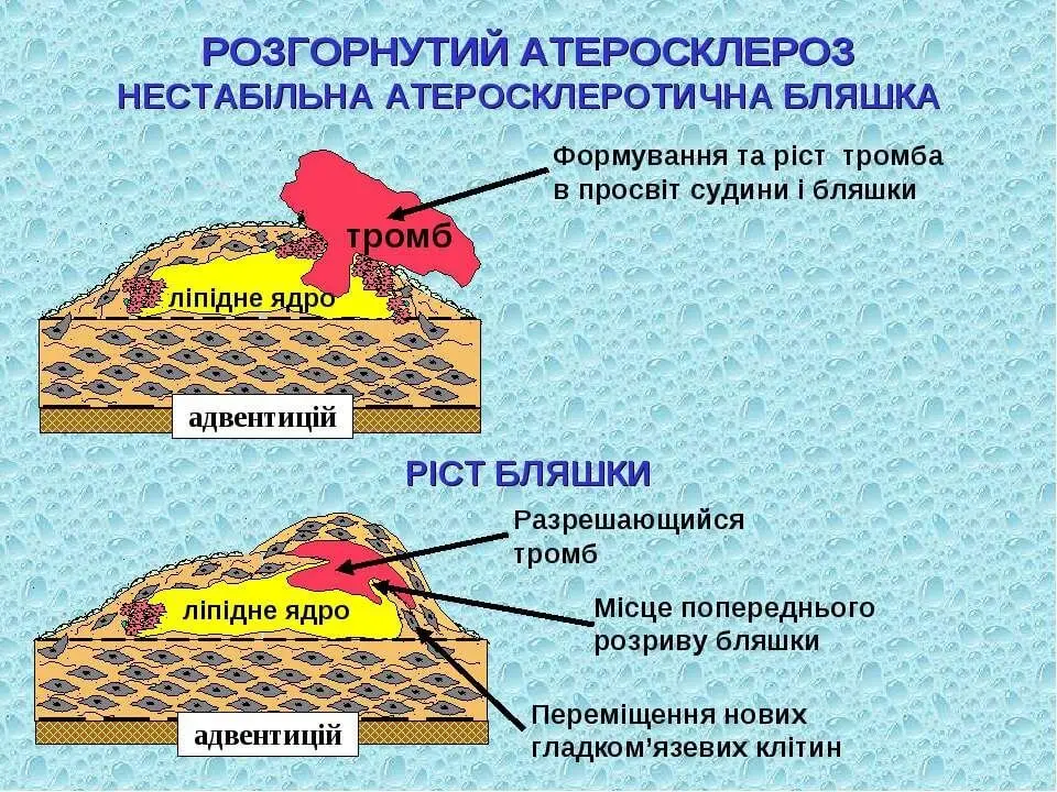 Ілюстрація професора кафедри терапії і сімейної медицини ФПО, д.м.н. Рудик Б.І., Київ Ілюстрація професора кафедри терапії і сімейної медицини ФПО, д.м.н. Рудик Б.І., Київ