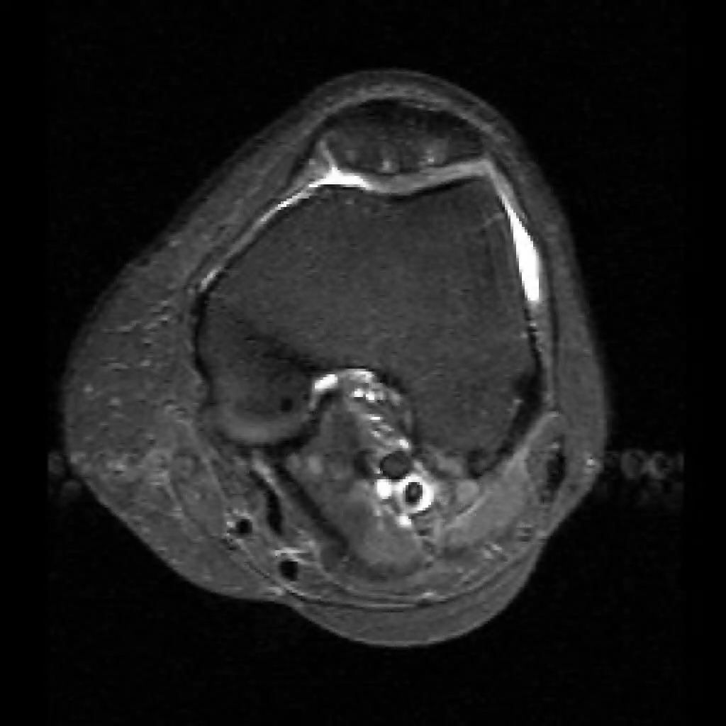 Біль в коліні. Лікування болю в коліні в Києві