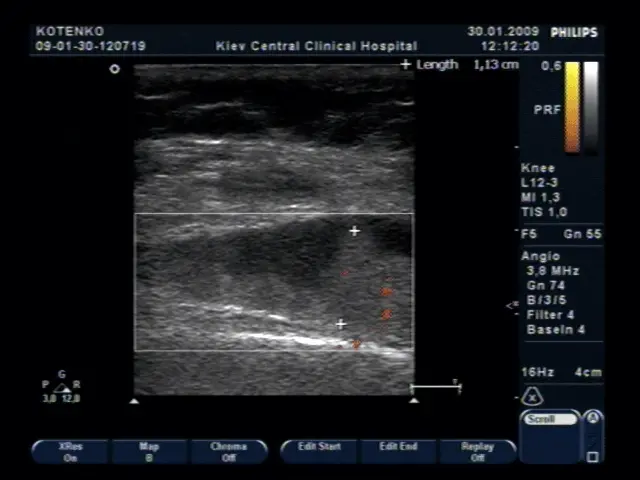 Біль в коліні. Лікування болю в коліні в Києві