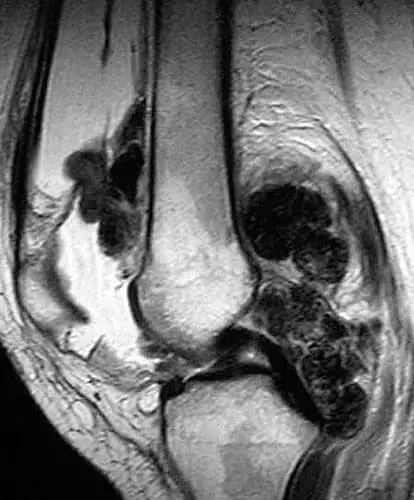 коліна болять