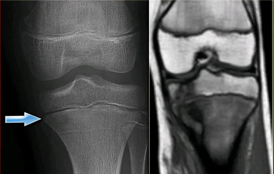 болить в колінах