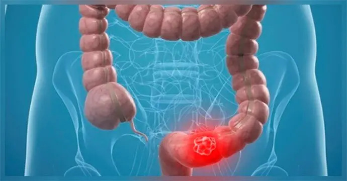 Болі внизу живота у жінок частіше лікує гінеколог