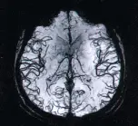 mrt 1 5 tesly firmy toshiba1.2