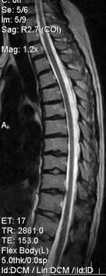 мрт шийного відділу
