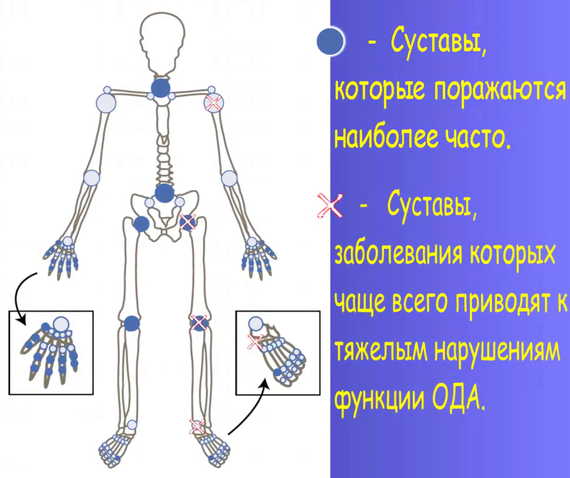 Лікування артрозу суглобів в Києві
