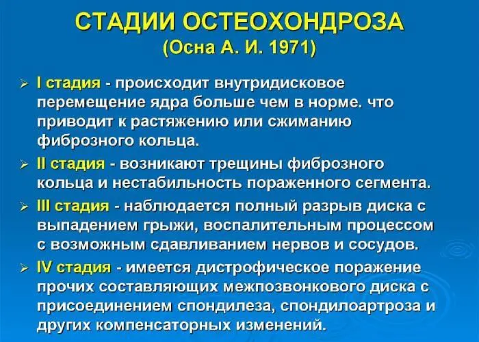 Стадии остеохондроза