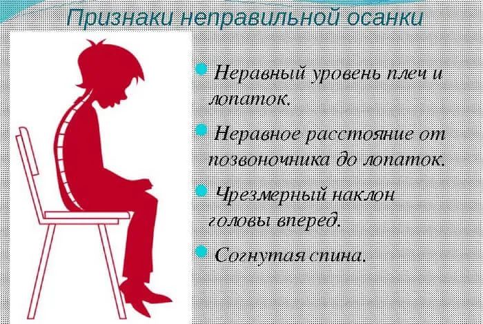 Неправильная осанка