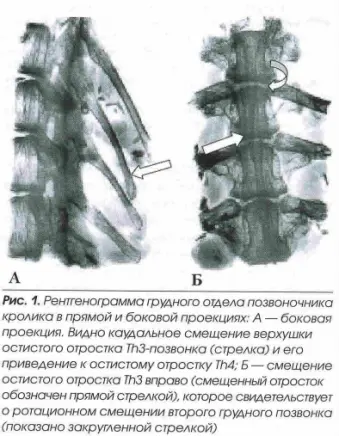 Рентгенограмма грудного отдела позвоночника fasetochnyj sindrom1
