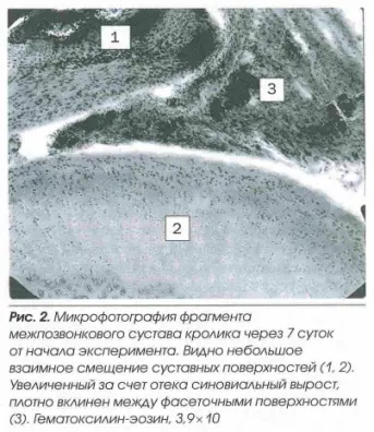 Микрофотография фрагмента межпозвонкового сустава кролика через 7 суток после начала эксперимента Микрофотография фрагмента межпозвонкового сустава кролика через 7 суток после начала эксперимента