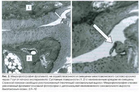 Микрофотография фрагмента не задействованного в смещении межпозвонкового сустава кролика через 7 дней после начала эксперимента Микрофотография фрагмента не задействованного в смещении межпозвонкового сустава кролика через 7 дней после начала эксперимента