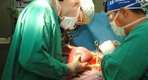 пересадка печінки пересадка печінки