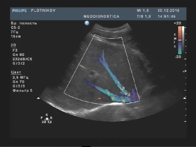 Показаннями до дослідження є Показаннями до дослідження є