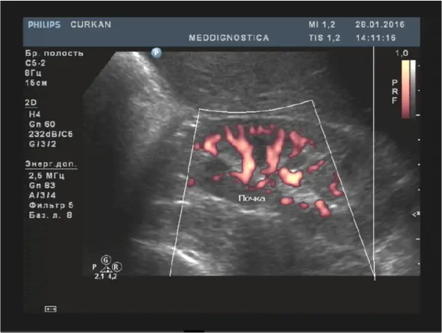 хід процедури хід процедури