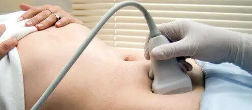 Ультразвукове дослідження органів малого таза Ультразвукове дослідження органів малого таза