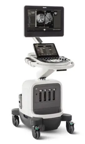 УЗД вен нижніх кінцівок PHILIPS УЗД вен нижніх кінцівок PHILIPS