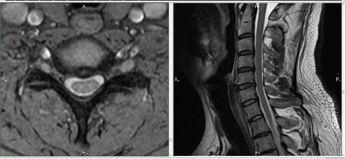 Лечение боли в шее в Киеве