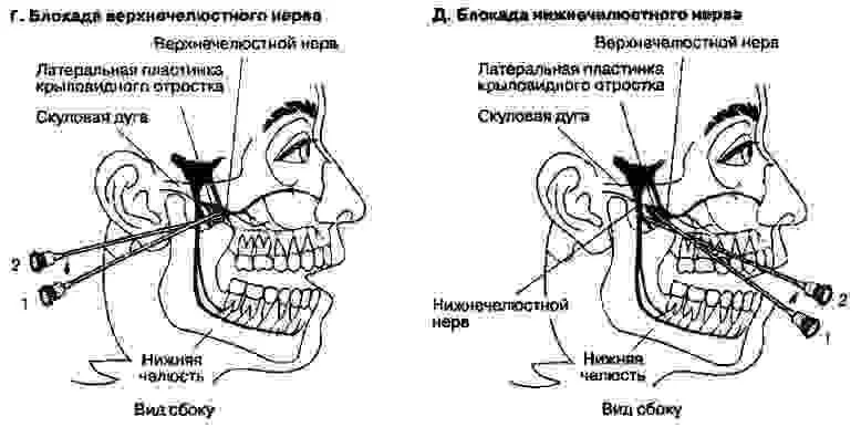 Лечение тройничного нерва Лечение тройничного нерва