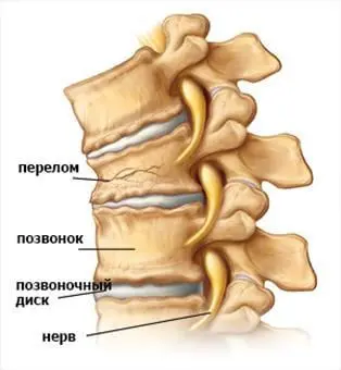 проблеми в хребті