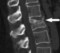 больовий синдром в грудях