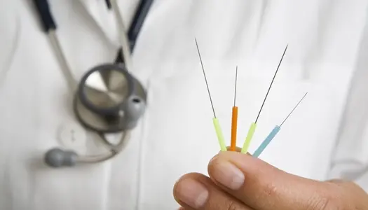 Иглоукалывание при болях в спине Иглоукалывание при болях в спине