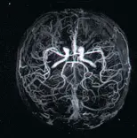 МРТ головного мозга МРТ головного мозга