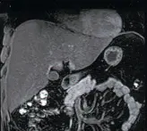 МРТ внутренних органов с возможностью онкологических исследований