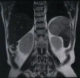 МРТ внутренних органов