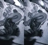 Органы малого таза Органы малого таза