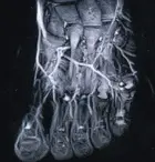 стопа с сосудами стопа с сосудами