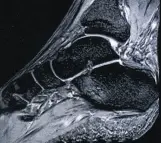 Голеностопный сустав Голеностопный сустав