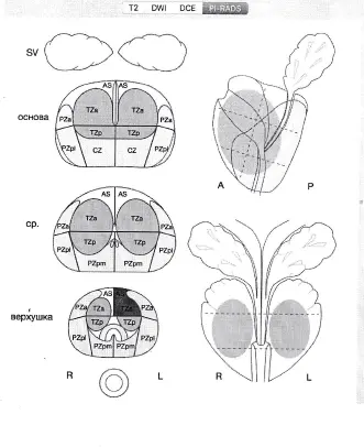 Протокол МРТ обследования предстательной железы Протокол МРТ обследования предстательной железы