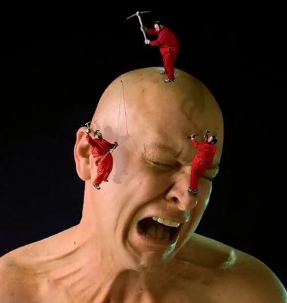 Диагностика и лечение мигрени