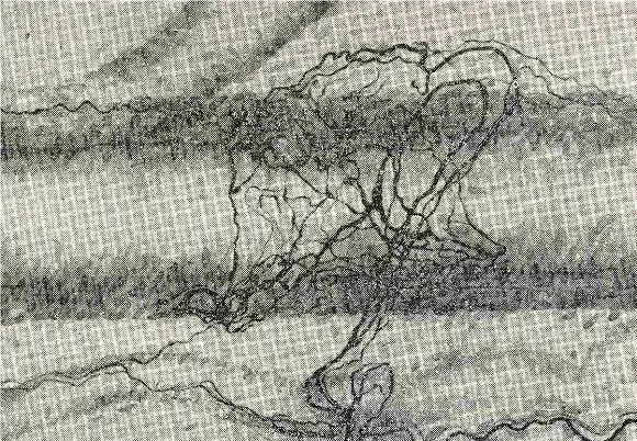 диагностика мигрени