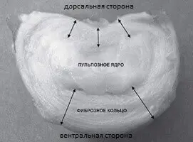 межпозвоночный диск