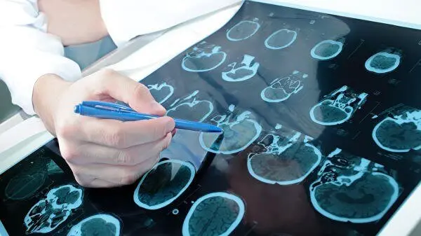 Старение начинается с сосудов мозга