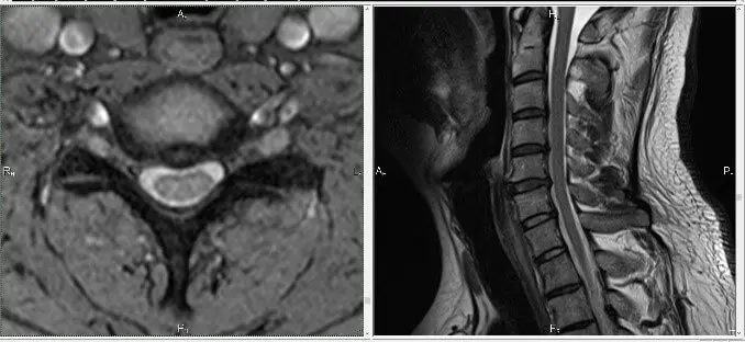 мрт шиї київ