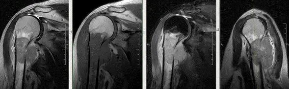 МРТ суглобів в Києві на Лівому березі