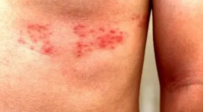 Причини болю в боці ліворуч, праворуч і що з цим робити