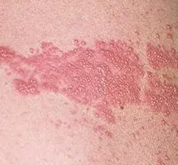 Причини болю в боці ліворуч, праворуч і що з цим робити