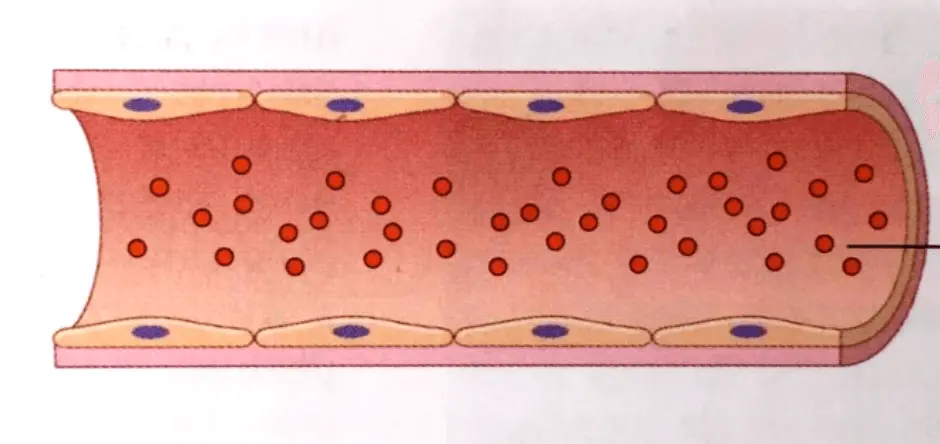Здоровый сосуд Здоровый сосуд