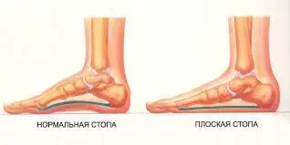 консультація ортопеда київ