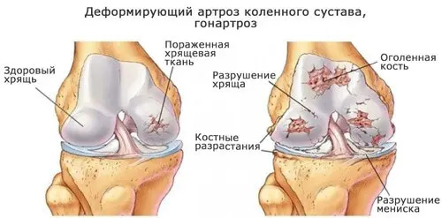 консультация врача ортопеда